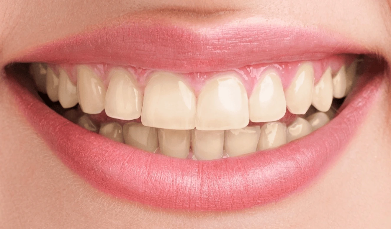 before-a.webp