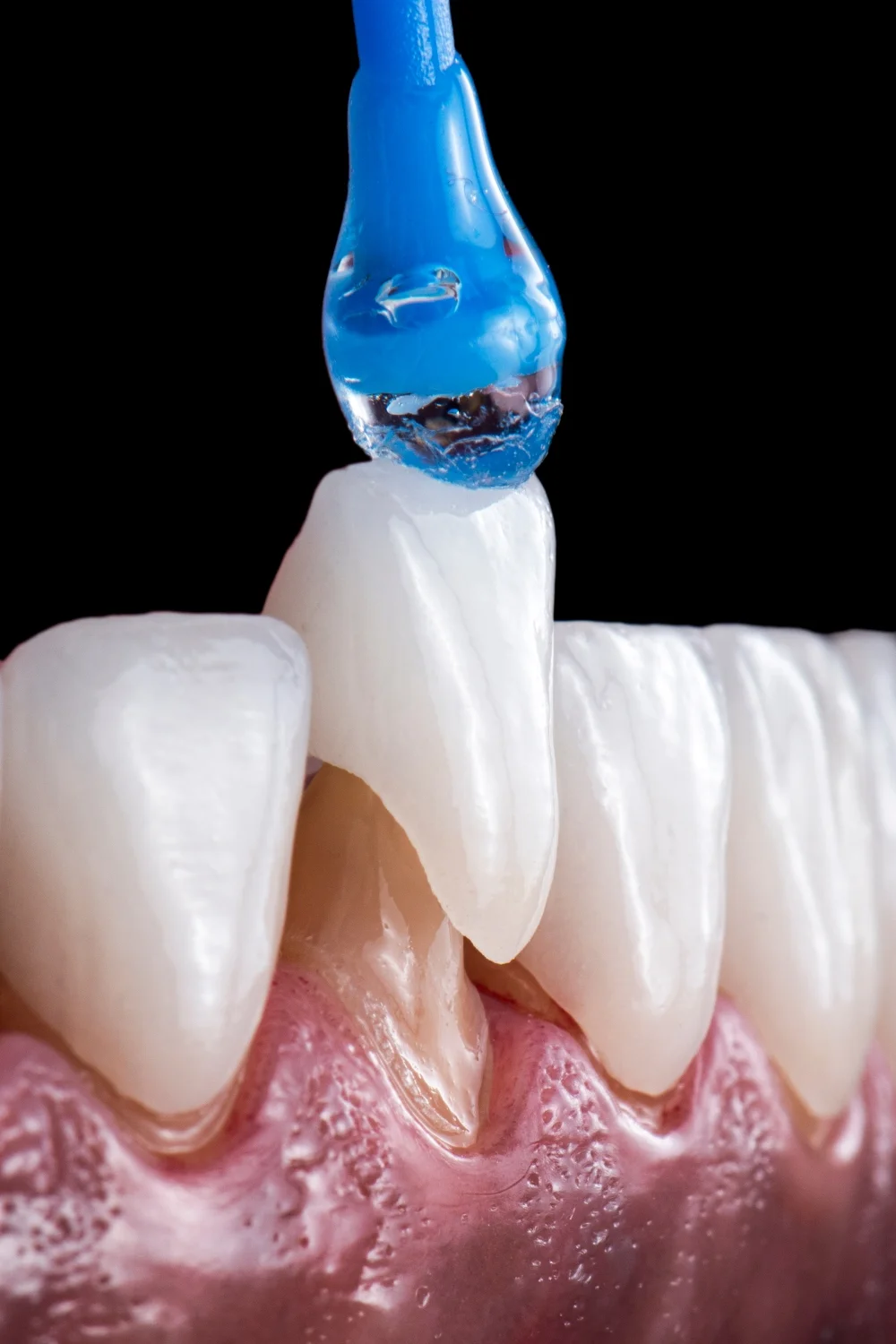north haven CT dental crown